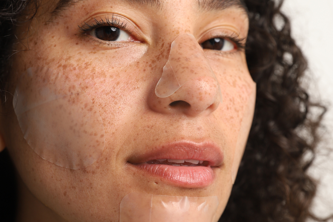 How Long to Leave Pimple Patches on and What to do After Removing 