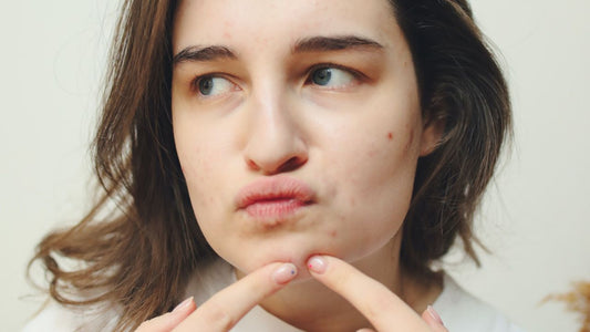 girl popping pimple